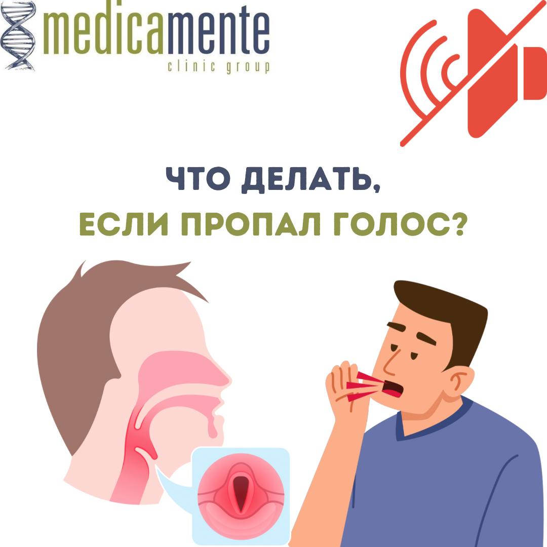 Что делать, если пропал голос?